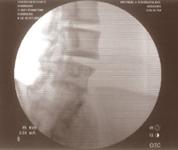 Fluoroscopic Image 2
