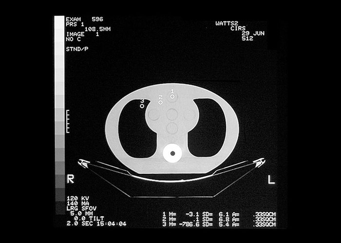 CIRS 002 LFC X-Ray Image