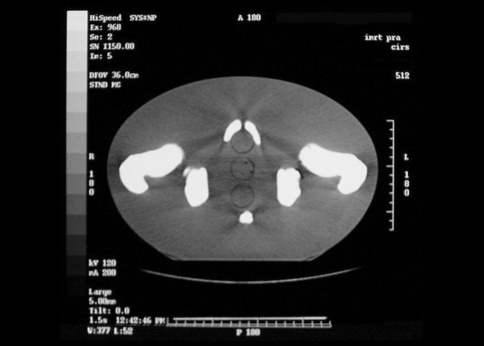 CIRS 002PRA CT 1