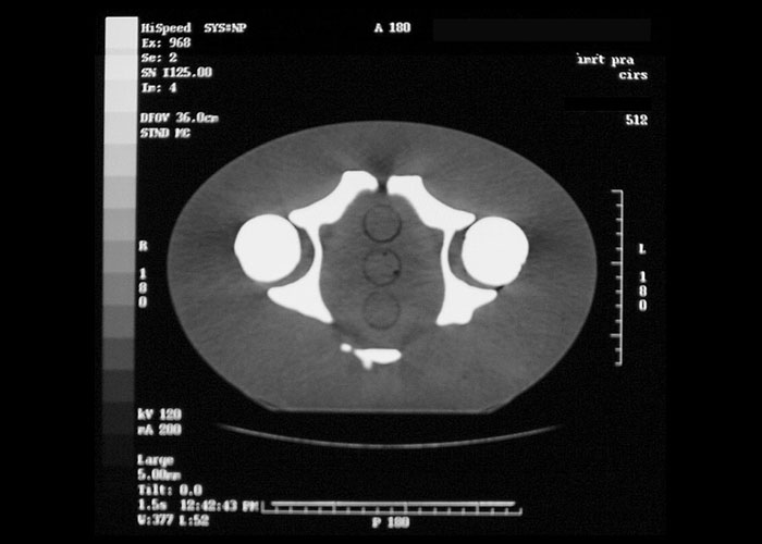 CIRS 002PRA CT 2