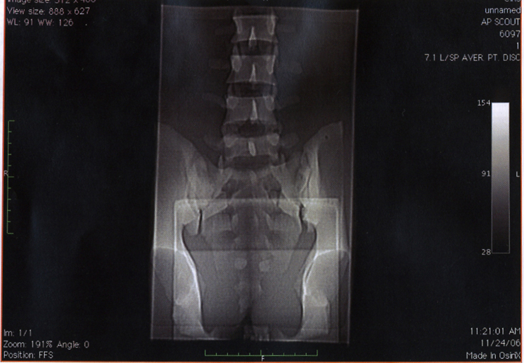 CIRS 034 Ultrasound/MR/CT