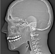 ATOMmax Sagittal View