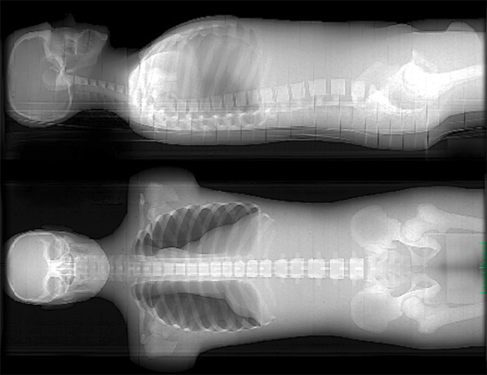 CIRS ATOM® Dosimetry Verification Phantoms x-ray