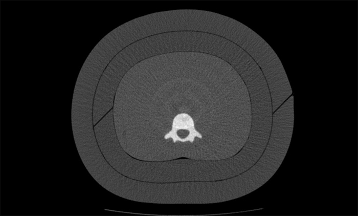 CIRS ATOM® CT Images of ATOM Fat Layers