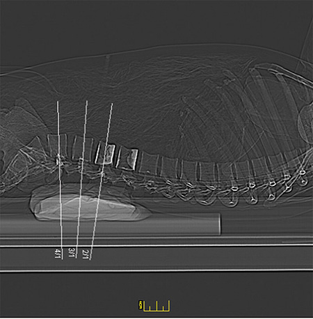 Erler Zimmer Natural Bone Full Body X-Ray Phantom - 7200 - xray 1