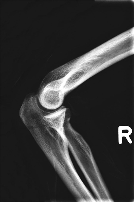 Erler Zimmer Natural Bone Full Body X-Ray Phantom - 7200 - xray 2
