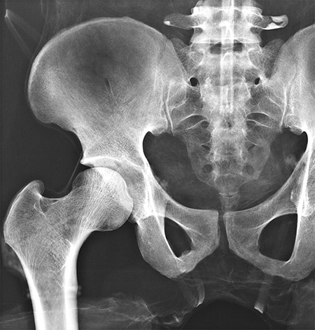 Erler Zimmer Natural Bone Full Body X-Ray Phantom - 7200 - xray 3