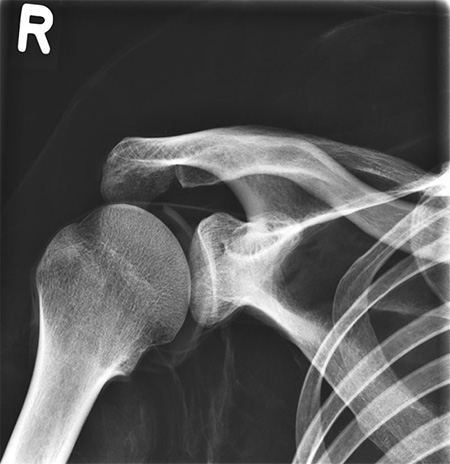 Erler Zimmer Natural Bone Full Body X-Ray Phantom - 7200 - xray 4
