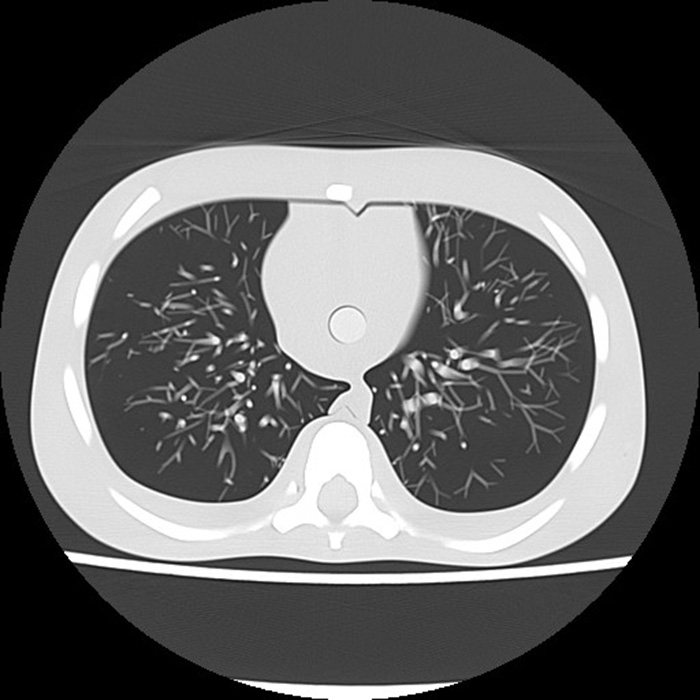 Pediatric Chest Phantom - PH-1C "LUNGBOY" Kyoto Kagaku