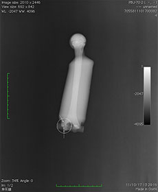 PBU-70 Arm with Pathology X-Ray
