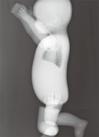 Whole Body Newborn Baby Phantom - X-Ray Image 2