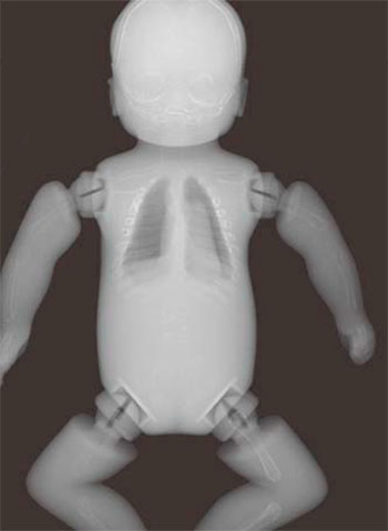 Whole Body Newborn Baby Phantom - X-Ray Image 3