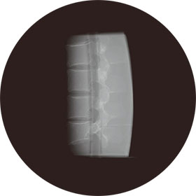 Lumbar Spine Fluoroscopy Training Phantom - anesthesia block