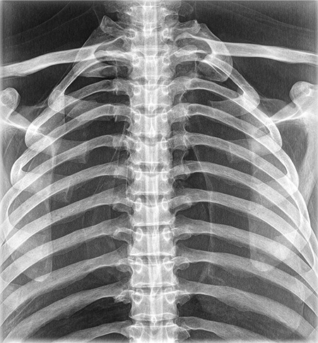 Erler Zimmer Natural Bone Full Body X-Ray Phantom - 7200 - xray 5
