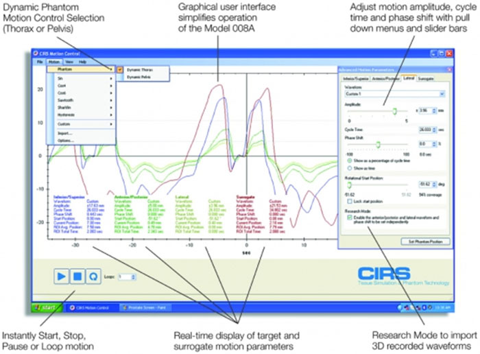 Dynamic Thorax Phantom CIRS 008A Specifications and Graph