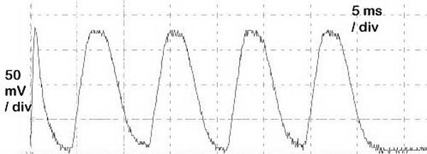 ECC XD88 Sample Oscilloscope Trace