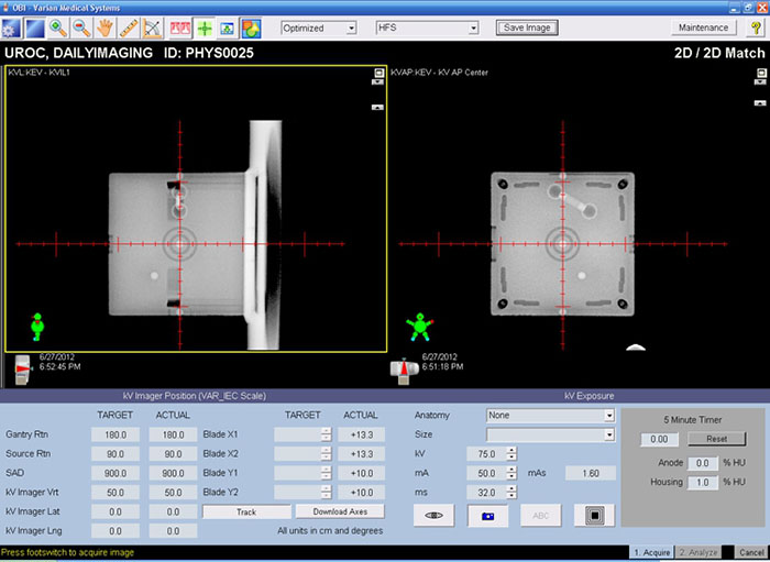 2D/2D match of kV and DRR