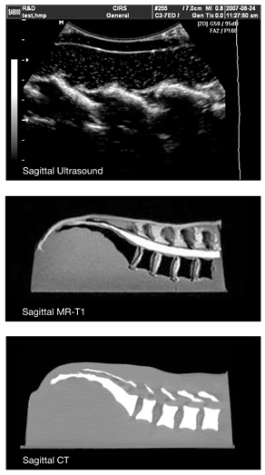 Lumbar Training Phantom CIRS 034 Ultrasound/MR/CT