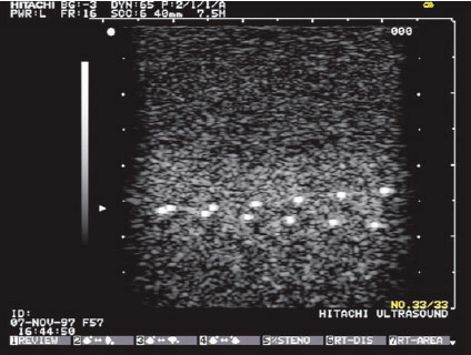 General Purpose Urethane Ultrasound Phantom CIRS 042 Ultrasound Image