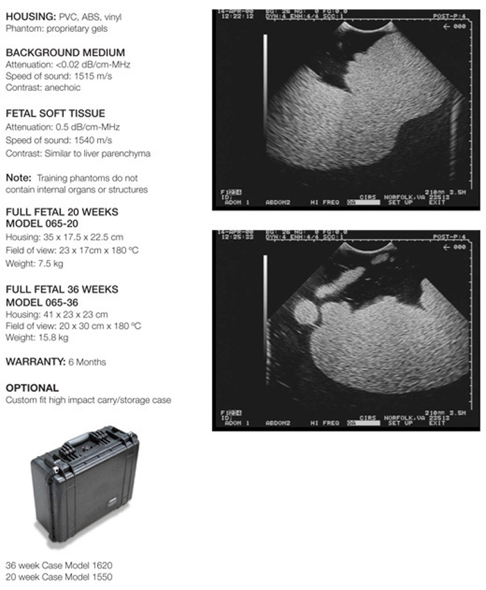 Fetal Ultrasound Training Phantom sold by Supertech