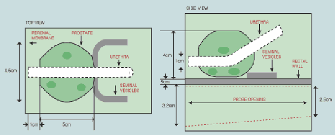 Prostate Elastography Ultrasound Phantom CIRS 066 Diagram