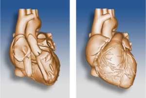 Cardiac Phantom
