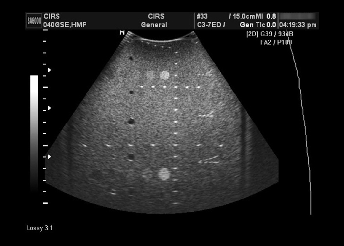Multi-Purpose Multi-Tissue Ultrasound Phantom CIRS 040GSE Ultrasound Image