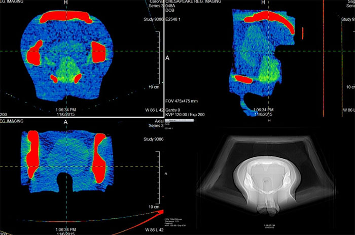 Multi-Modality Pelvic Phantom CIRS 048A Ultrasound/MRI/CT CT and SCOUT image