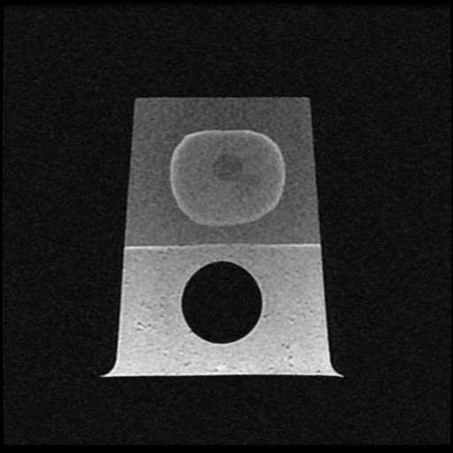 CIRS 053L MRI T1