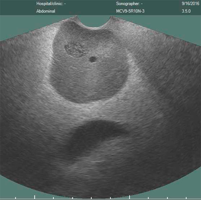 CIRS 070L Ultrasound