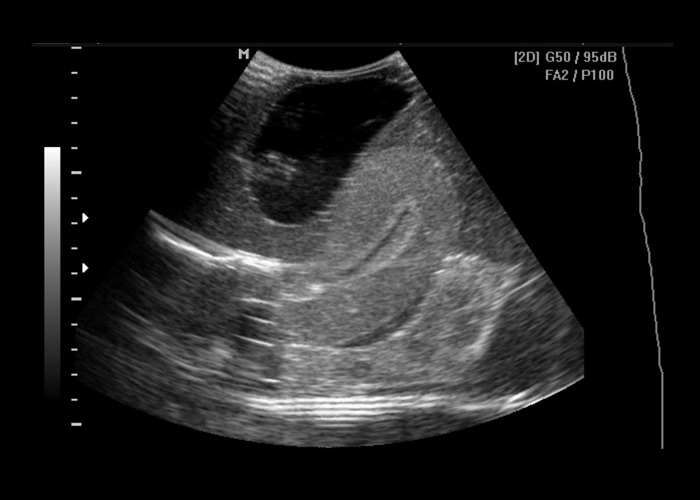 Female ultrasound phantom vaginal training pelvis cirs 404A with