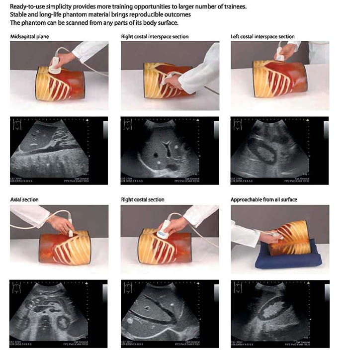 ABDFAN Ultrasound Scans