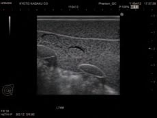 Ultrasound Scan 3