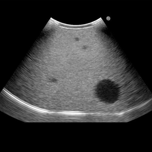 Fundamental Ultrasound Phantom - Kyoto Kagaku - US-18 - Ultrasound 2