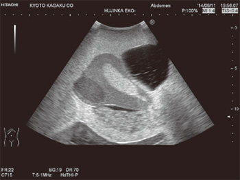US-10 Pathological Phantom Ultrasound 1