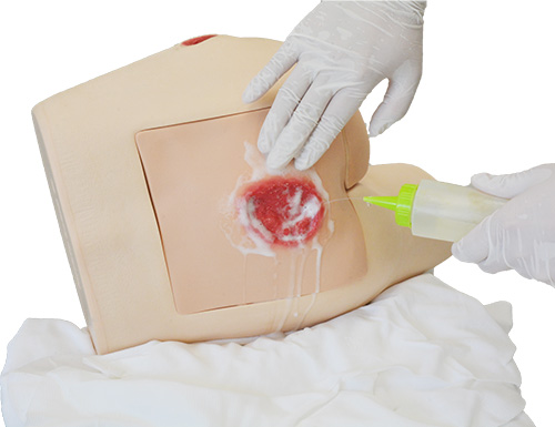 Pressure Sores Simulator - MW63 - Kyoto Kagaku - wound cleaning