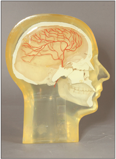 Angiographic Head Phantoms