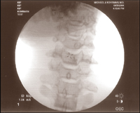 Fluoroscopic Image 1