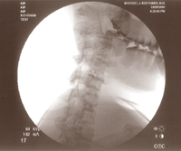 Fluoroscopic Image 3