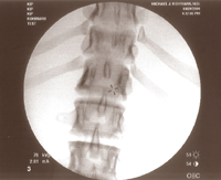 Fluoroscopic Image 4