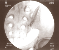 Fluoroscopic Image 5