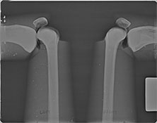 BREAK-APART PIXY Knees X-Ray 2