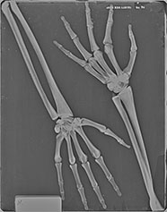 BREAK-APART PIXY Hands X-Ray