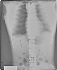 TAKE-APART PIXY Torso X-Ray