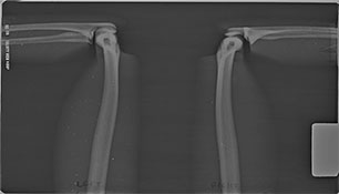 TAKE-APART PIXY Knees X-Ray 1