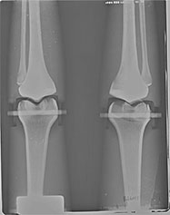TAKE-APART PIXY Legs X-Ray 1