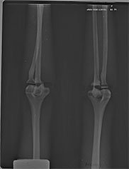 TAKE-APART PIXY Legs X-Ray 2
