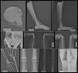 TAKE-APART PIXY X-Ray Images