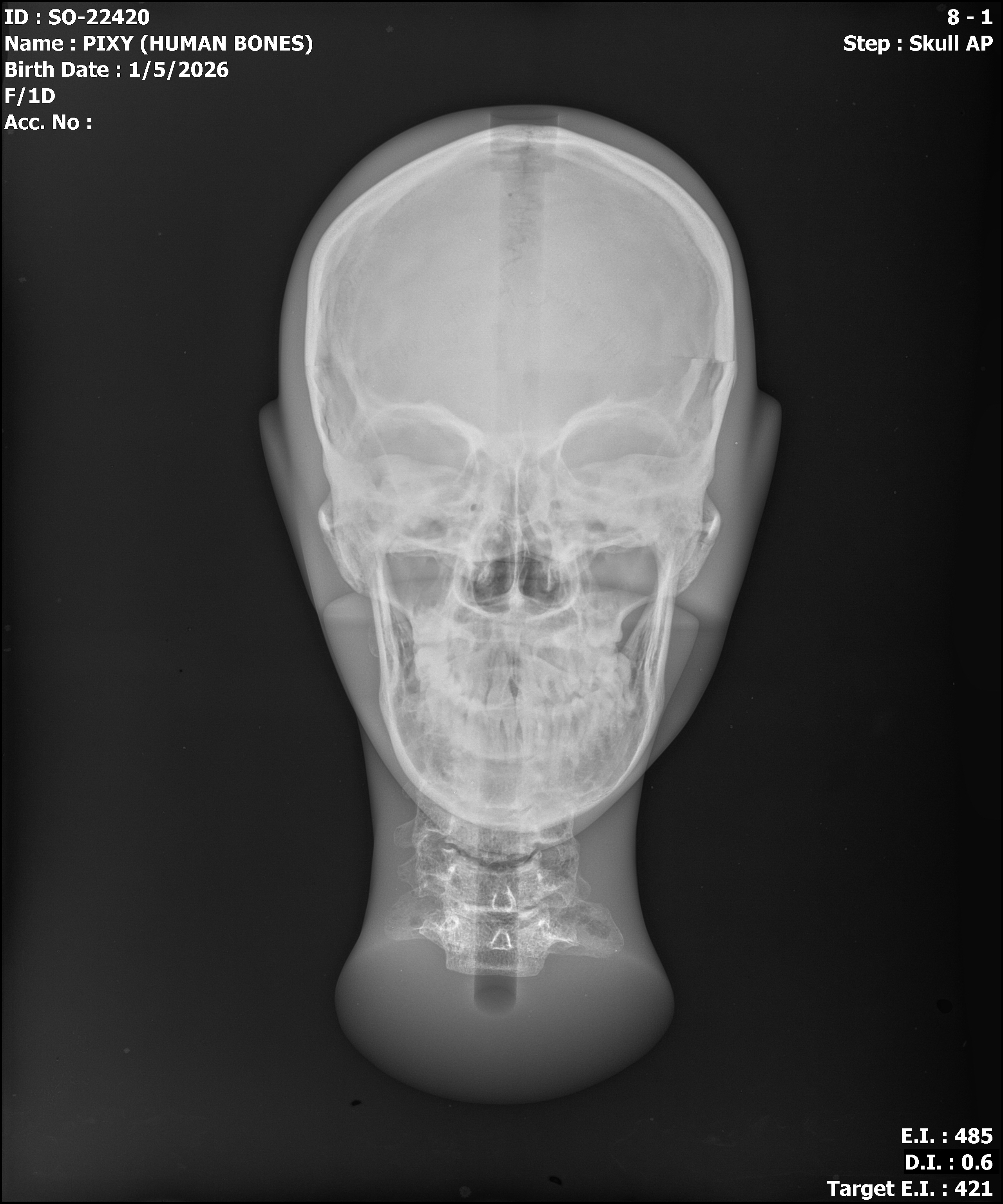 Cadaver bone full body phantom X-ray - head and neck AP view