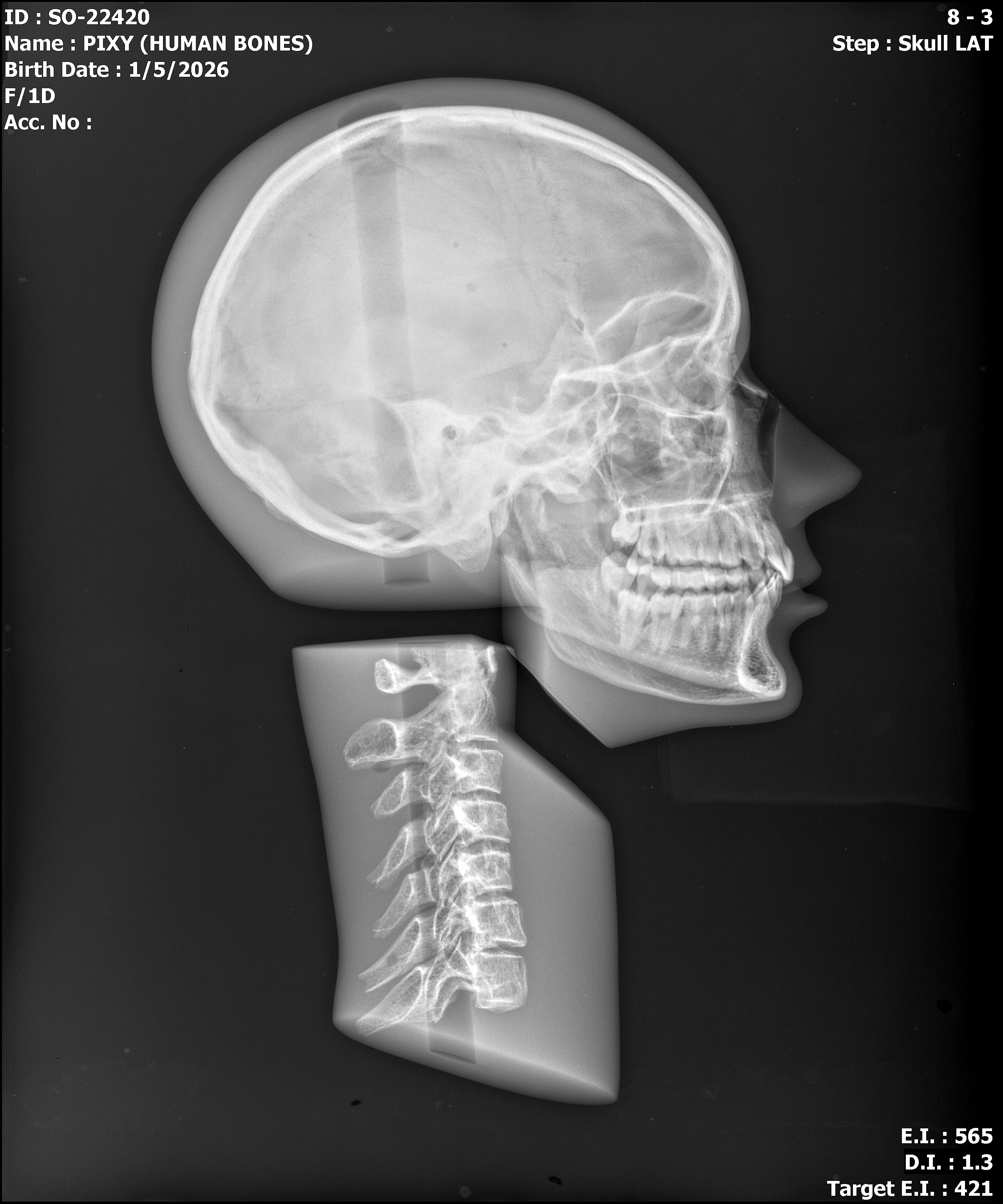 Cadaver bone full body phantom X-ray - head and neck lateral view